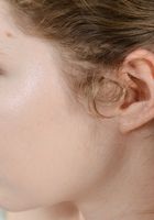 ATK Natural & Hairy: Apricot Pitts (Apricot Pitts in young and hairy)