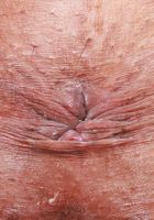 ATK Exotics: Apryl Rein (Apryl Rein in Shorts)