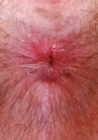 Big Eyes from ATK Natural & Hairy