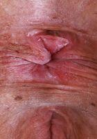 Dolly Paige from ATK Galleria