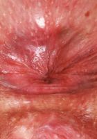 ATK Natural & Hairy: Dria Submits (Dria Submits Dresses Nicely Just To Take It All Off)