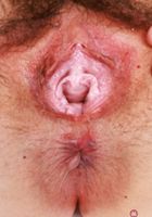 ATK Natural & Hairy: Dria Submits (Dria Submits submits her hairy body for your approval)