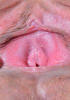 ATK Premium: Ember Stone (Ember Stone in amateur)