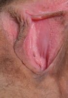 ATK Natural & Hairy: Ember Stone (Ember spreads her furry pink flower)