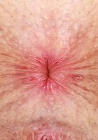 ATK Petites: Fiona Sprouts (Fiona Peaches is in a lovely mood)