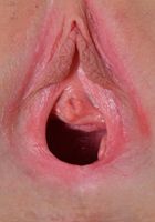 Ivy Aura Gaping Big, Ivy Aura (ivy018) ATK Galleria: Ivy Aura (Ivy Aura Gaping Big)