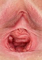 ATK Galleria: Ivy Aura (Ivy Aura Huge Gaping Outdoors)