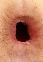 Jackie Hoff Huge Hole, Jackie Hoff (jac041) ATK Petites: Jackie Hoff (Jackie Hoff Huge Hole)