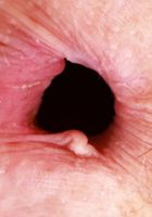 ATK Petites: Jackie Hoff (Jackie Hoff Spreading her Beautiful Bush and Ass)