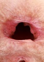 ATK Natural & Hairy: Jackie Hoff (Jackie Hoff is sporting a wild bush)