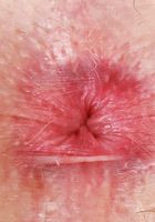 ATK Petites: Kate Bloom (Kate Bloom Takes Her Panties Off)