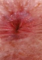 ATK Galleria: Krystal Palmer (Krystal Palmer Panty Flash Pussy Spreads)