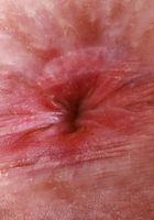 ATK Petites: Krystal Palmer (Krystal Palmer is all dolled up)