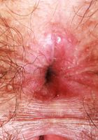 Kyra Rose Outdoor Spreading, Kyra Rose (kyr006) ATK Natural & Hairy: Kyra Rose (Kyra Rose Outdoor Spreading)