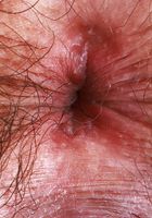 ATK Natural & Hairy: Kyra Rose (Kyra Rose Red Lingerie)