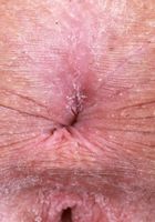 Lily Winters from ATK Galleria