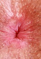 Pearl Sage models her hairy body, Pearl Sage (pea013) ATK Natural & Hairy: Pearl Sage (Pearl Sage models her hairy body)