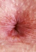 Remi Raw sheds her lingerie, Remi Raw (rem006) ATK Petites: Remi Raw (Remi Raw sheds her lingerie)