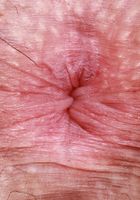 ATK Petites: Remi Raw (Remi Raw is looking sexy and fun)