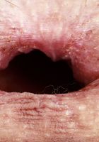 ATK Galleria: Rose Winters (Rose Winters Sexy Upskirt)