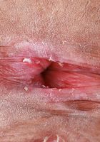 Salee Lee Wide Exotic Pussy Spreads, Salee Lee (sal024) ATK Petites: Salee Lee (Salee Lee Wide Exotic Pussy Spreads)