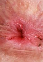 Scarlet Skies Spreads and Gapes her Young Pussy, Scarlet Skies (sca046) ATK Petites: Scarlet Skies (Scarlet Skies Spreads and Gapes her Young Pussy)