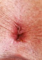 Selina Bentz Upskirt & Spreading, Selina Bentz (sel016) ATK Galleria: Selina Bentz (Selina Bentz Upskirt & Spreading)