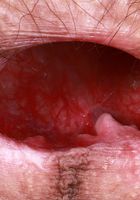 ATK Natural & Hairy: Sia Wood (Sia Wood Stockings Big Bush Spreading)