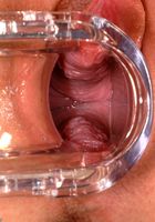 ATK Archives: Sunny (Sunny in toys)