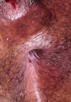 ATK Exotics: Tahyti (Black model Tahyti spreads her hole)